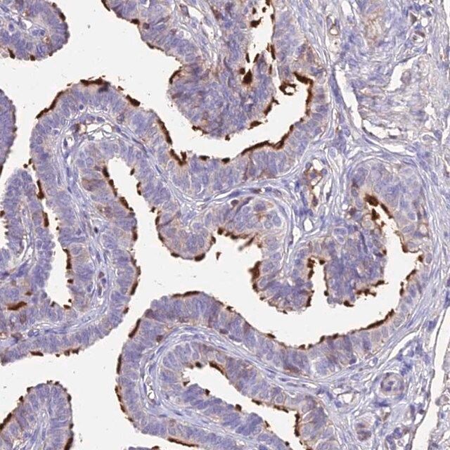 Anti-NME5 antibody produced in rabbit