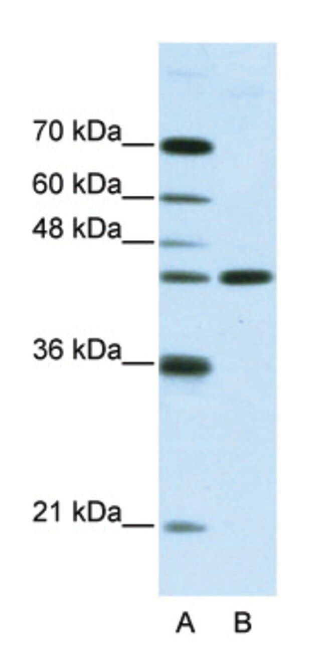 Anti-NMUR2 (N-terminal) antibody produced in rabbit