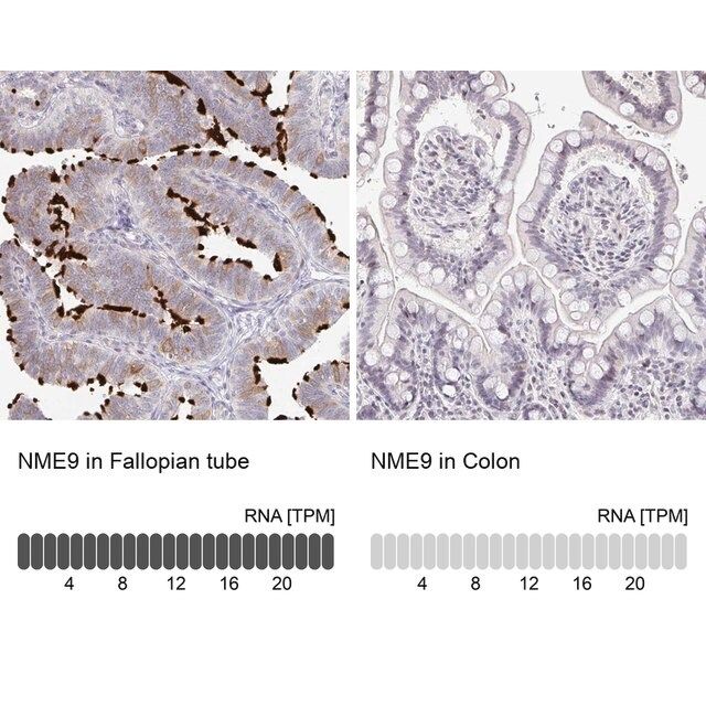 Anti-NME9 antibody produced in rabbit