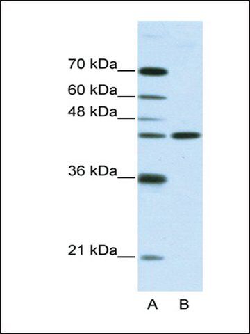 Anti-NMUR2 antibody produced in rabbit