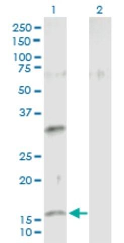 Anti-NMU antibody produced in mouse