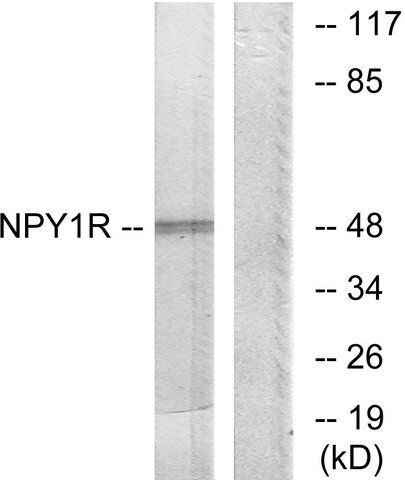 Anti-NPY1R antibody produced in rabbit