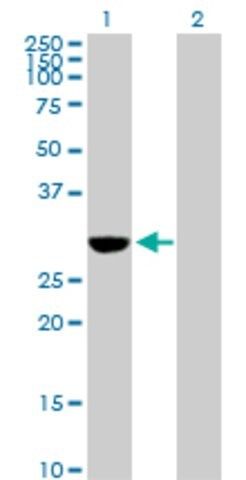 Anti-NQO1 antibody produced in rabbit