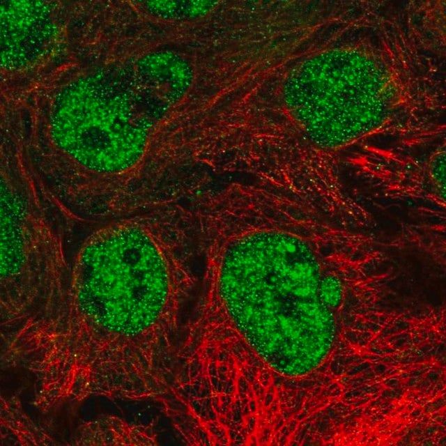 Anti-NR6A1 antibody produced in rabbit