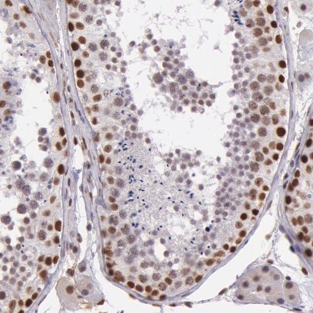 Anti-NBN antibody produced in rabbit