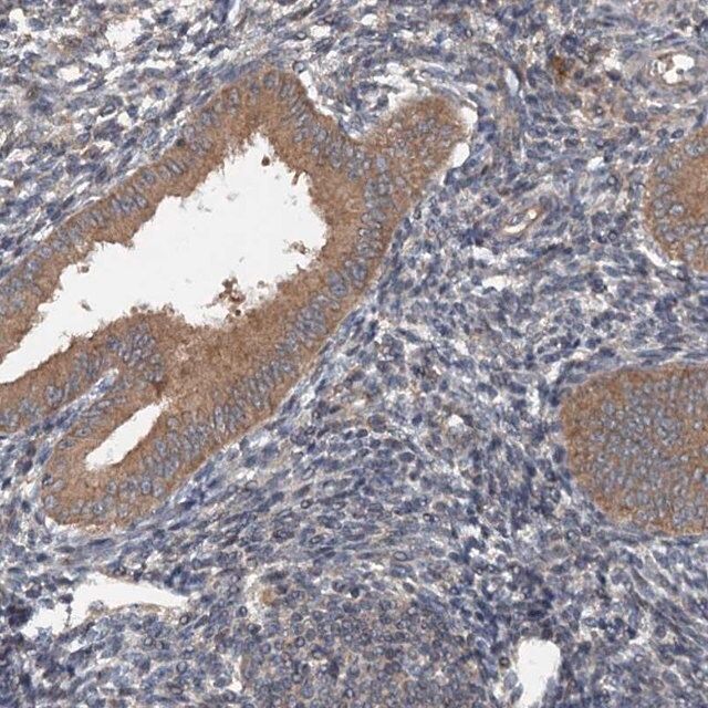 Anti-N4BP2L2 antibody produced in rabbit