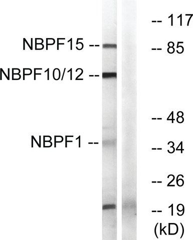 Anti-NBPF1 antibody produced in rabbit