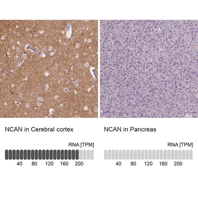 Anti-NCAN antibody produced in rabbit