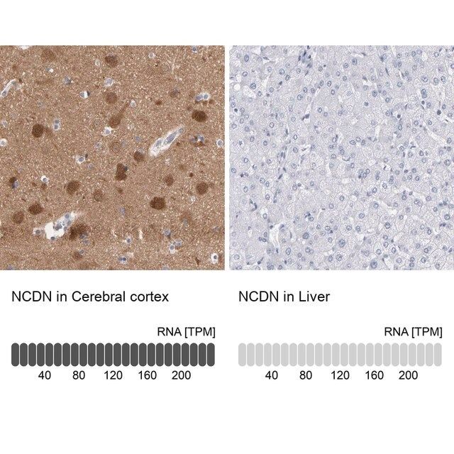 Anti-NCDN antibody produced in rabbit