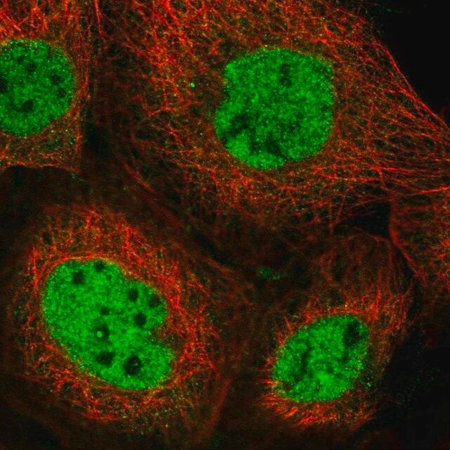 Anti-NCOA6 antibody produced in rabbit
