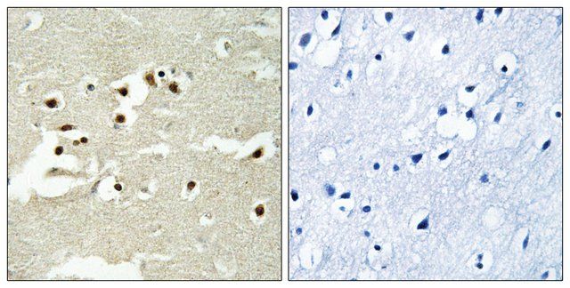Anti-NCOA5 antibody produced in rabbit