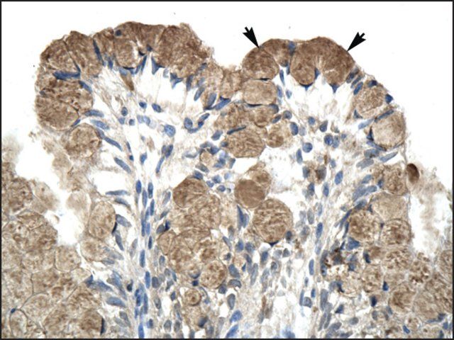 Anti-NCOR1 antibody produced in rabbit