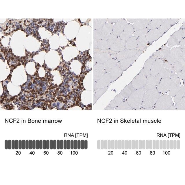 Anti-NCF2 antibody produced in rabbit