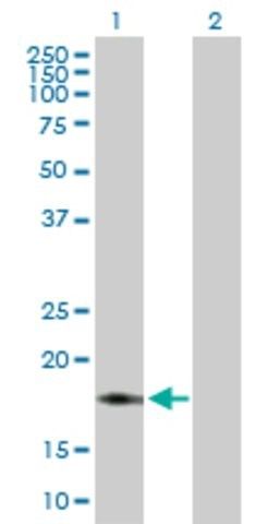 Anti-NDUFB7 antibody produced in rabbit