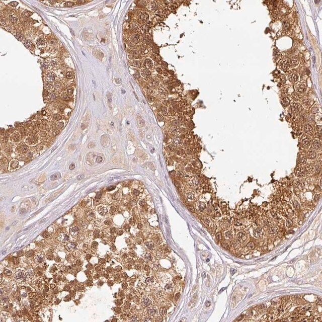 Anti-NDUFB2 antibody produced in rabbit