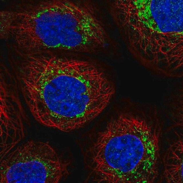 Anti-NDUFB6 antibody produced in rabbit