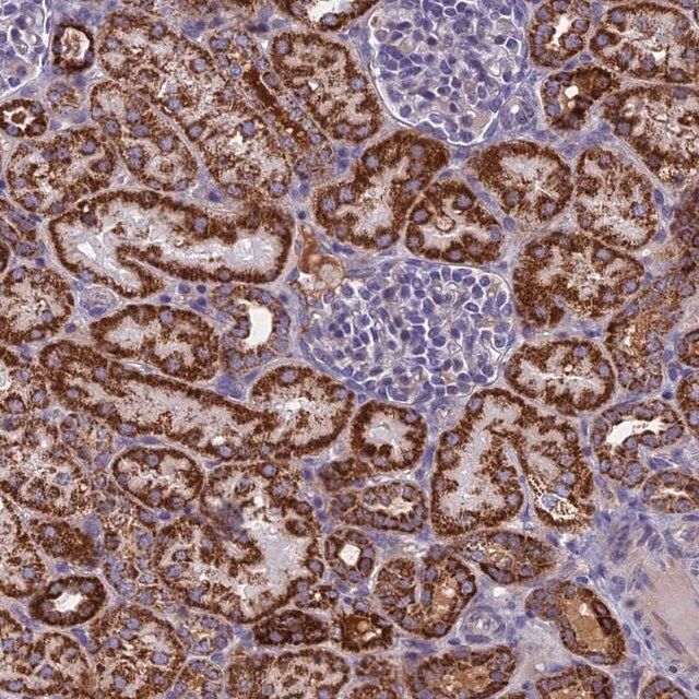 Anti-NDUFB9 antibody produced in rabbit