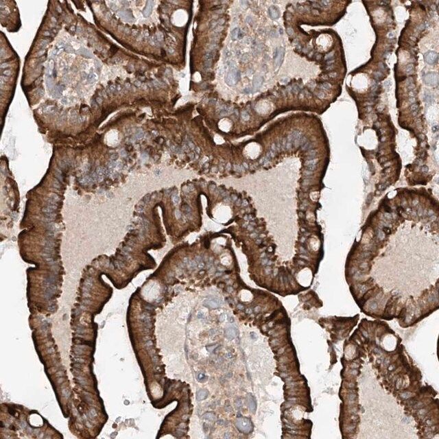 Anti-MTUS2 antibody produced in rabbit
