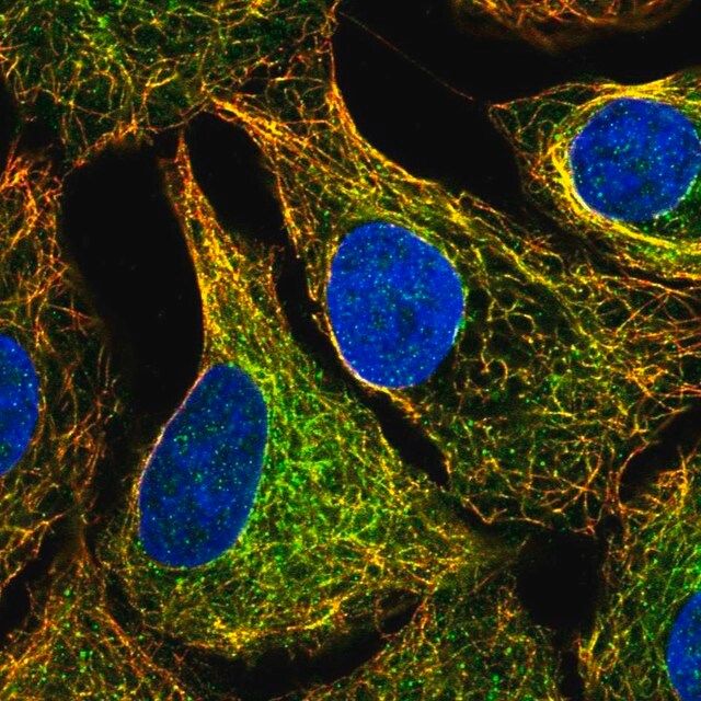 Anti-MTUS1 antibody produced in rabbit