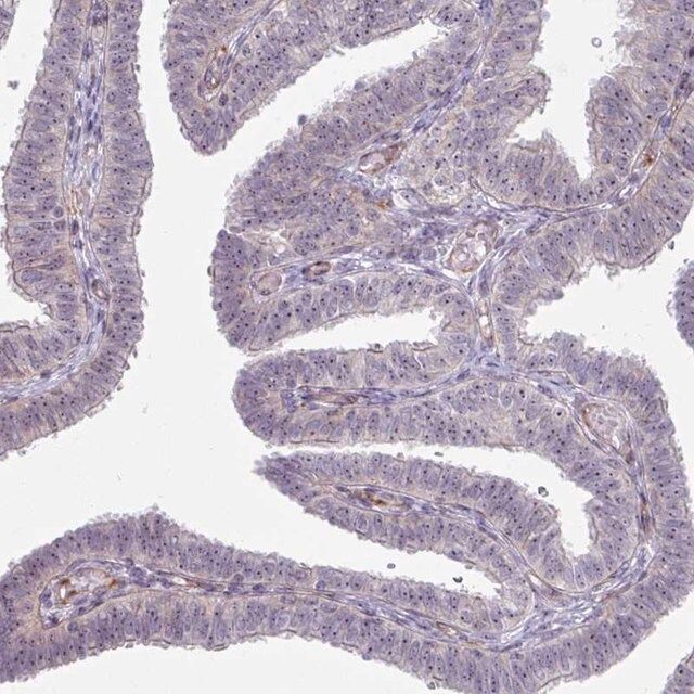 Anti-MUS81 antibody produced in rabbit