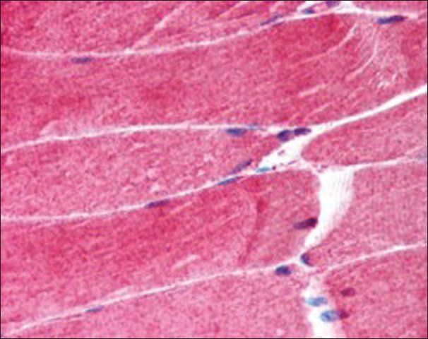 Anti-MURF1/TRIM63, N-Terminal antibody produced in goat