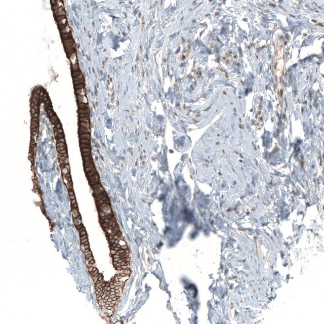 Anti-MXRA8 antibody produced in rabbit