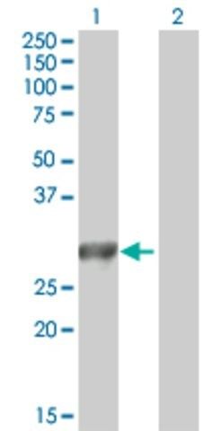 ANTI-MYO3A antibody produced in mouse