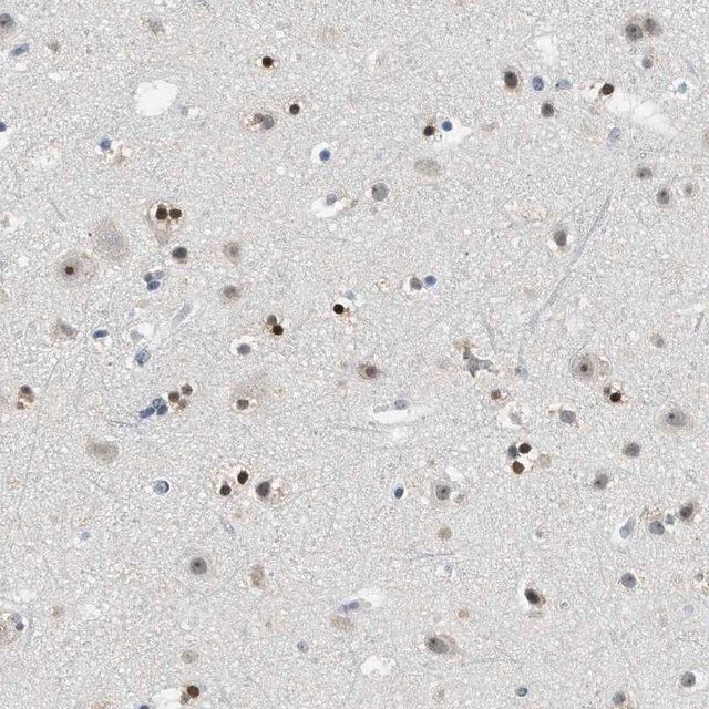 Anti-MZF1 antibody produced in rabbit