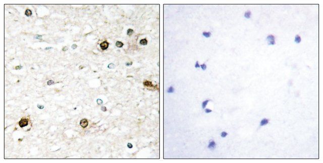 Anti-NAB2 antibody produced in rabbit
