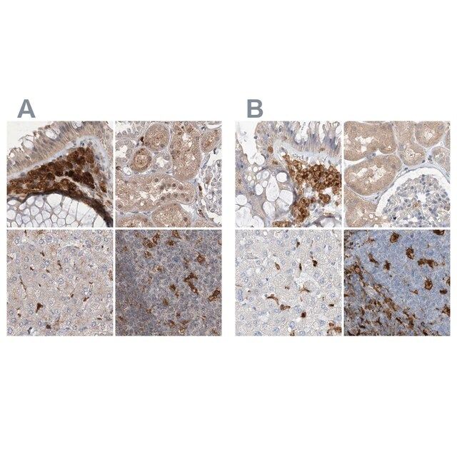 Anti-NAGK antibody produced in rabbit