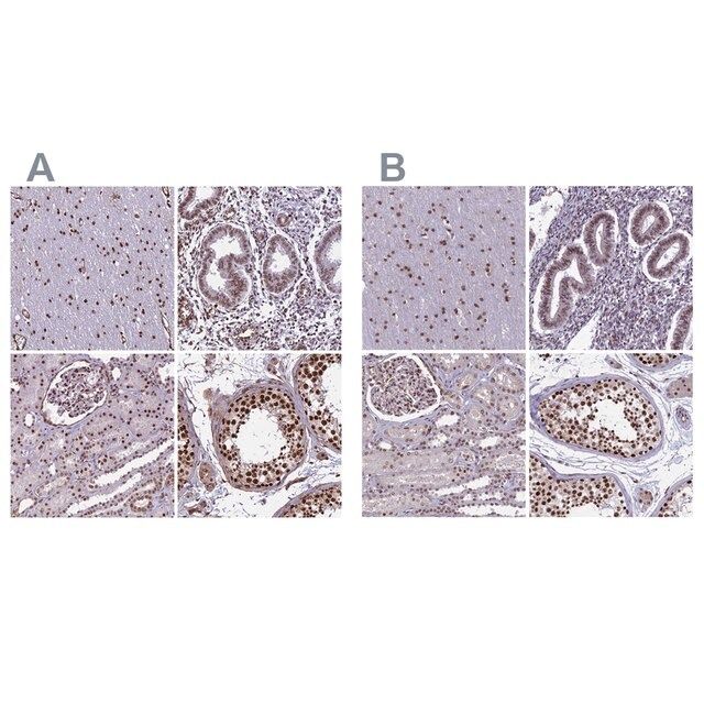 Anti-MPHOSPH8 antibody produced in rabbit