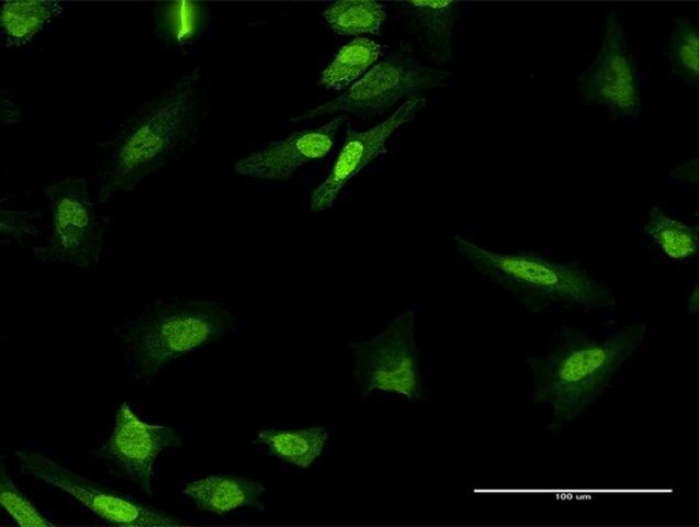 Anti-MPHOSPH8 antibody produced in mouse