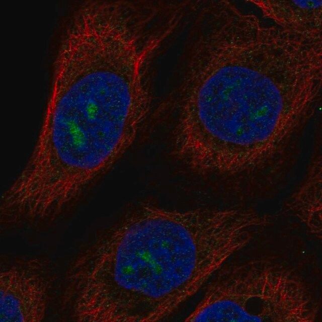 Anti-MPPED2 antibody produced in rabbit