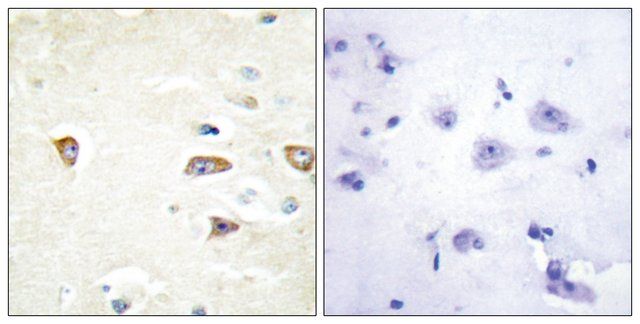 Anti-MRCKB antibody produced in rabbit