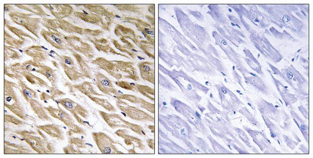 Anti-MRPL39 antibody produced in rabbit