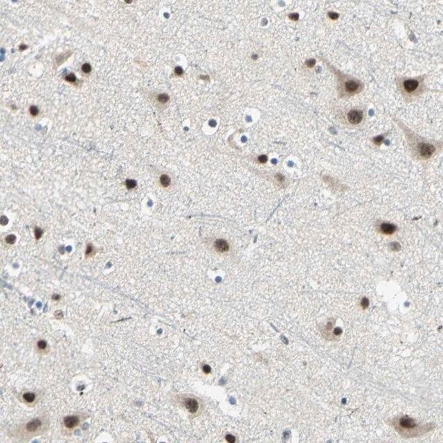 Anti-MTA1 antibody produced in rabbit