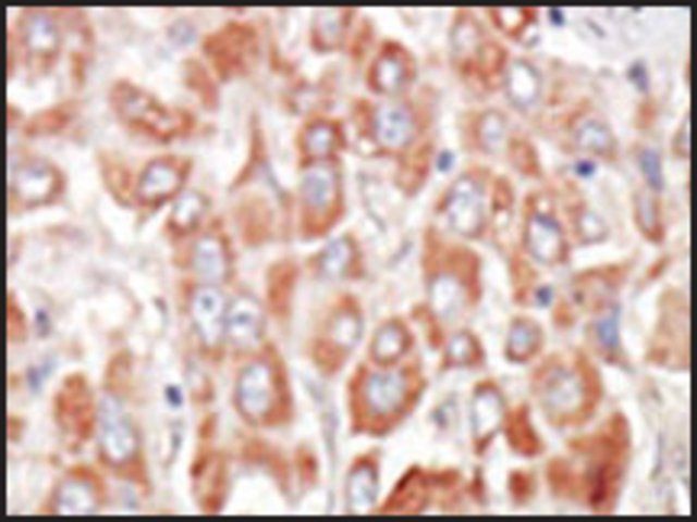 Anti-MSSK1 (center) antibody produced in rabbit
