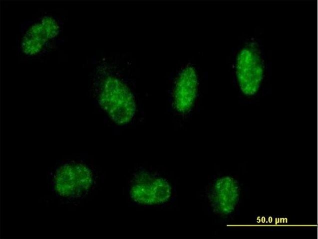 Anti-MTMR8 antibody produced in mouse