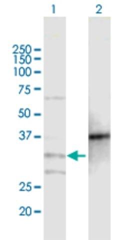 Anti-MOGAT2 antibody produced in mouse