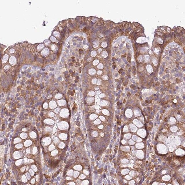 Anti-MOCS3 antibody produced in rabbit