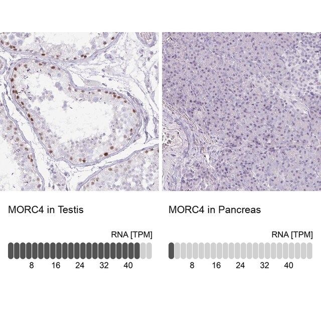 Anti-MORC4 antibody produced in rabbit