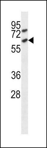 ANTI-MOUSE ACVR1C (C-TERM) antibody produced in rabbit