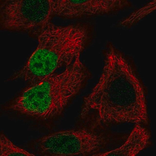 Anti-MORC4 antibody produced in rabbit