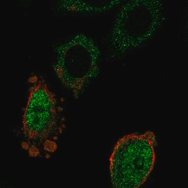 Anti-MOSPD3 antibody produced in rabbit
