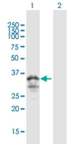 ANTI-MOGAT3 antibody produced in mouse