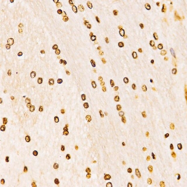Anti-MonoMethyl-Histone H3-K27 antibody produced in rabbit