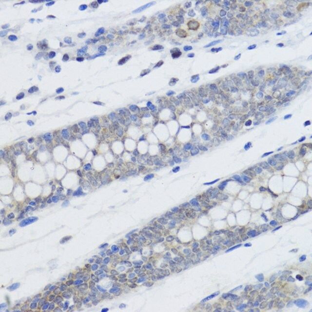 Anti-MonoMethyl-Histone H4-K20 antibody produced in rabbit
