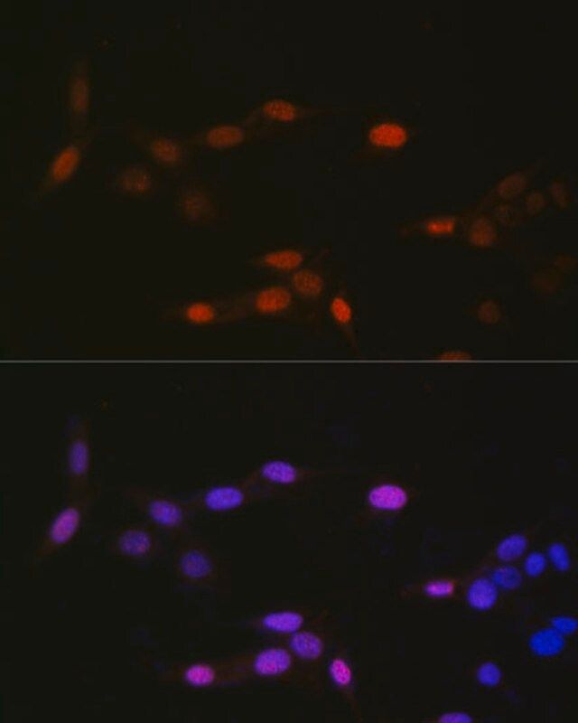 Anti-MonoMethyl-Histone H3-K14 antibody produced in rabbit