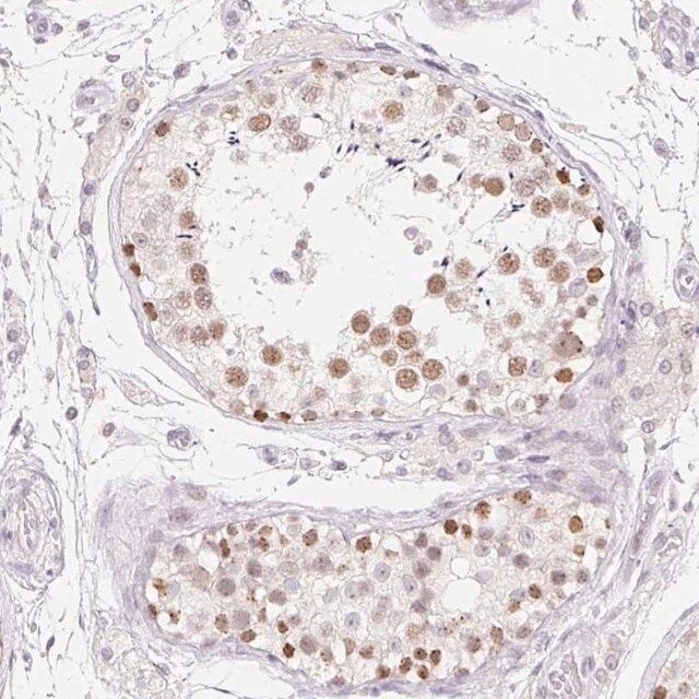 Anti-MORC1 antibody produced in rabbit