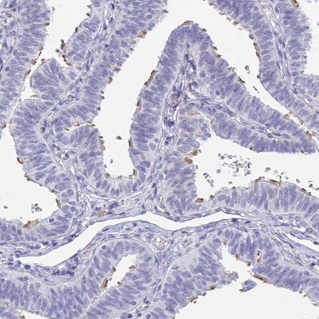 Anti-MORN2 antibody produced in rabbit